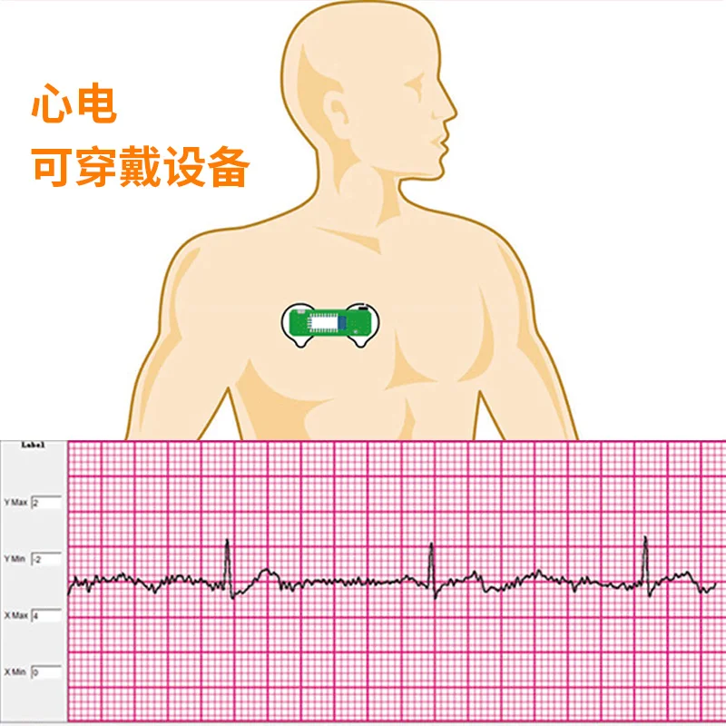 BMD101 ECG Electrocardiogram S - Ecg Patch Monitor recensie en prijs